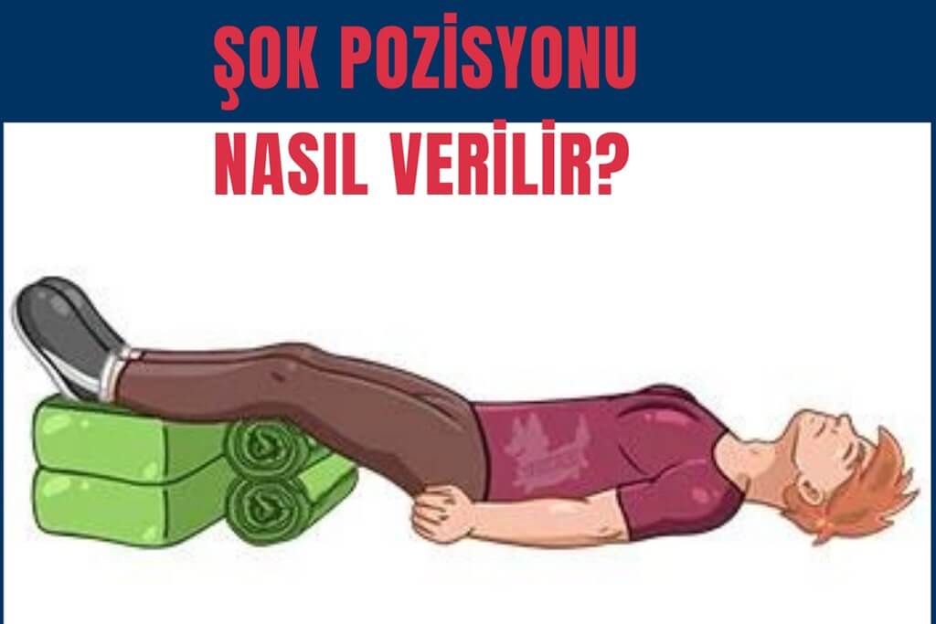 Şok Pozisyonu Nasıl Verilir?